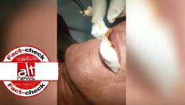 Video of Parasite Removal from a Person’s lip Falsely Linked With Coronavirus